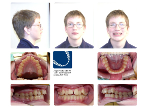 before orthodontic treatment