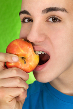 boy with braces biting an apple