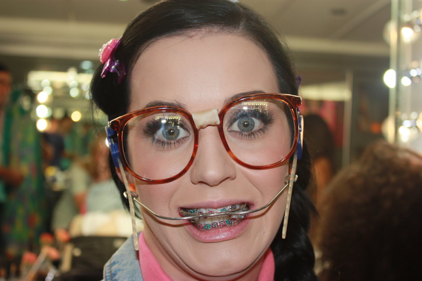 Katy Perry wearing braces and headgear